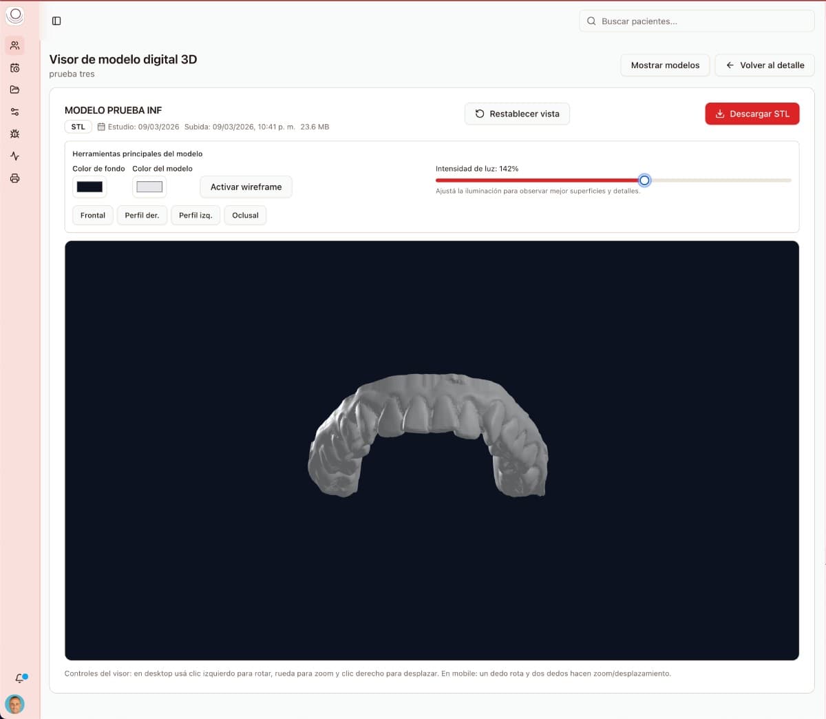 Visor completo de un modelo dental STL, con controles de orientación y zoom